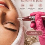 Microneedling en action, technique de soins de la peau pour rajeunir et revitaliser.