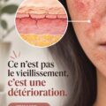 Femme souriante appliquant un soin sur son visage, symbolisant le soin anti-âge.