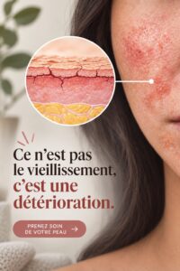 Femme souriante appliquant un soin sur son visage, symbolisant le soin anti-âge.
